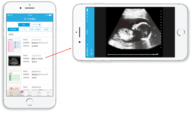 図１：赤ちゃんの超音波画像の表示イメージ