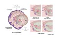 【医療図解解説】病態と手術手技をどう結び付けて伝えるか