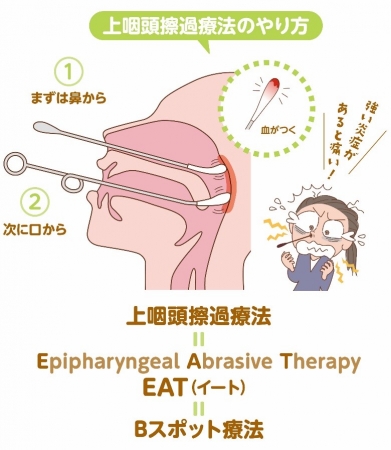 のどの違和感 鼻水 鼻づまり 頭痛 肩こり 首こり 長引くその症状の原因は 慢性上咽頭炎 だった 株式会社扶桑社のプレスリリース