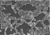 アクネ菌の電子顕微鏡写真
