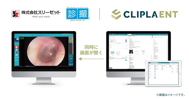 Clipla Ezcap 耳鼻咽喉科向けクラウド電子カルテ Clipla Ent クリプラ エント の販売を開始 株式会社エムティーアイのプレスリリース