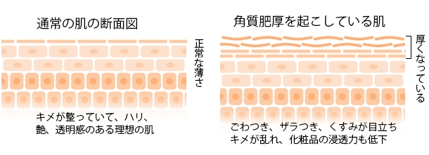 年齢によって 実感が半減 ドクターが説く 美肌力を底上げする方法 株式会社ドクターシーラボのプレスリリース