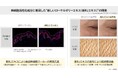 ローヤルゼリーに新知見　肌の角層水分量と真皮の厚みを向上させ、シワやキメを改善独自