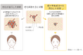 老化細胞から分泌される炎症性物質を抑制　ローヤルゼリーが「老化の連鎖を食い止める」ことを世界で初めて解明