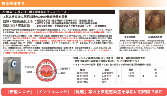 炎症 コロナ 血管 血管炎症反応の仕組み解明 新型コロナで大阪大チーム｜あなたの静岡新聞