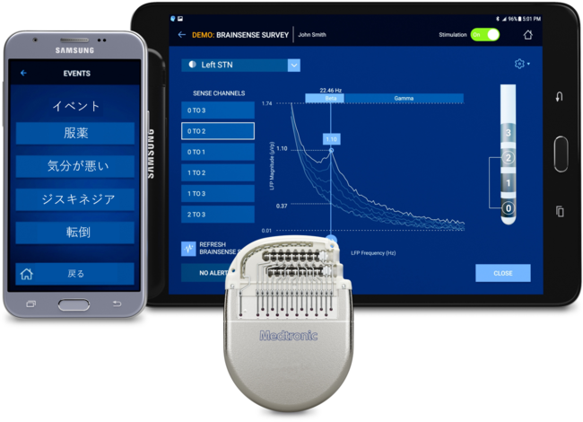 「メドトロニックPercept(TM) PC」（承認番号：30200BZX00163000）