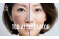 TCB東京中央美容外科の新テレビCM「TCB AIエイジングケア シミ取り」篇 6月11日(水)より全国でオンエア開始