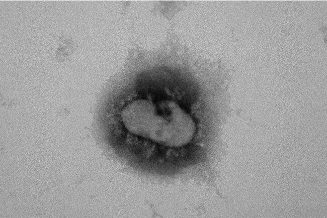 透過型電子顕微鏡写真：ナノイー（帯電微粒子水）照射あり
