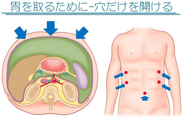 医師向けipadアプリ 3 7万dl実績 活用で 日本初の本格的な患者説明スライド無料 ライブラリ を開始 医療現場の悩み 時間不足の医師 もっと説明を受けたい患者 を解消 Qlifeのプレスリリース