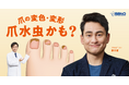 爪水虫の疾患啓発を目的とするTVCMを全国で放映開始