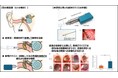 当社の針なしジェットインジェクション技術を用いた内耳疾患治療応用に関する研究成果が発表されました