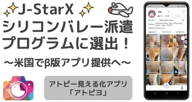J-StarXシリコンバレー選出-アトピヨ