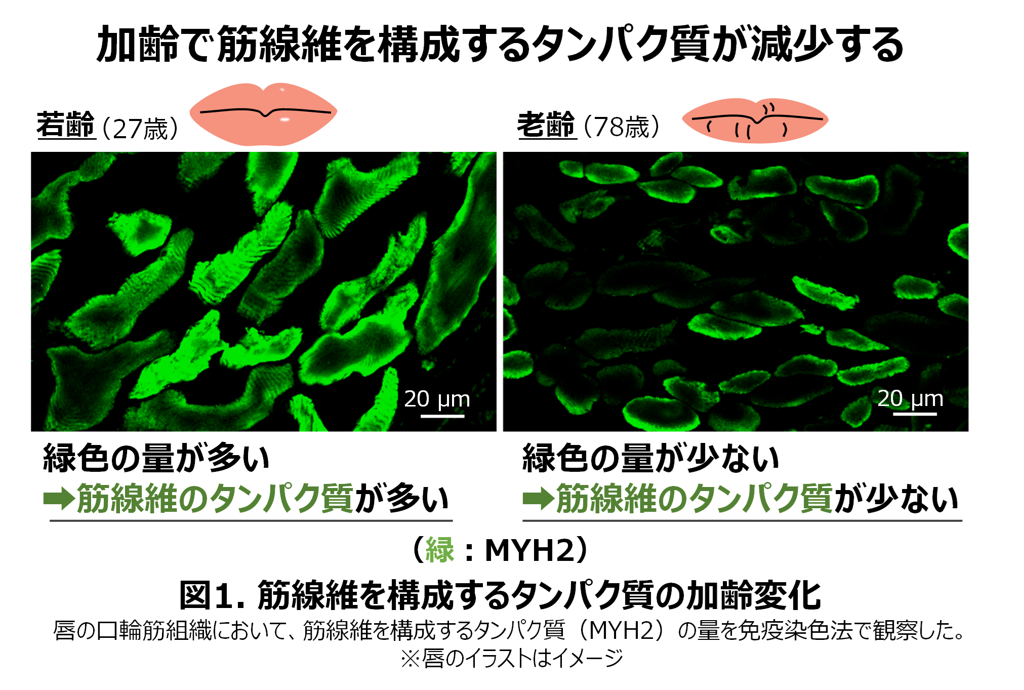 唇の新知見 加齢でボリュームが減ると同時に筋タンパク質が減少筋タンパク質を強化する唇独自の細胞間ネットワークを発見 ポーラのプレスリリース