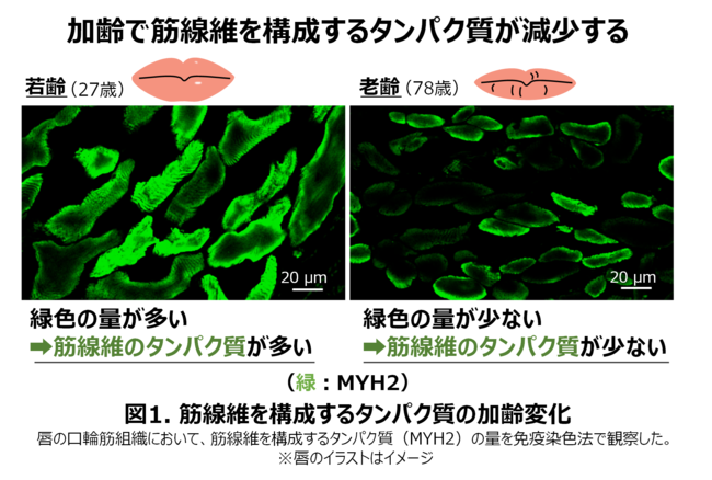 Pola New Knowledge Of Lips Volume Decreases With Aging And Muscle Protein Decreases At The Same Time Discovering A Unique Intercellular Network Of Lips That Strengthens Muscle Protein Japan News