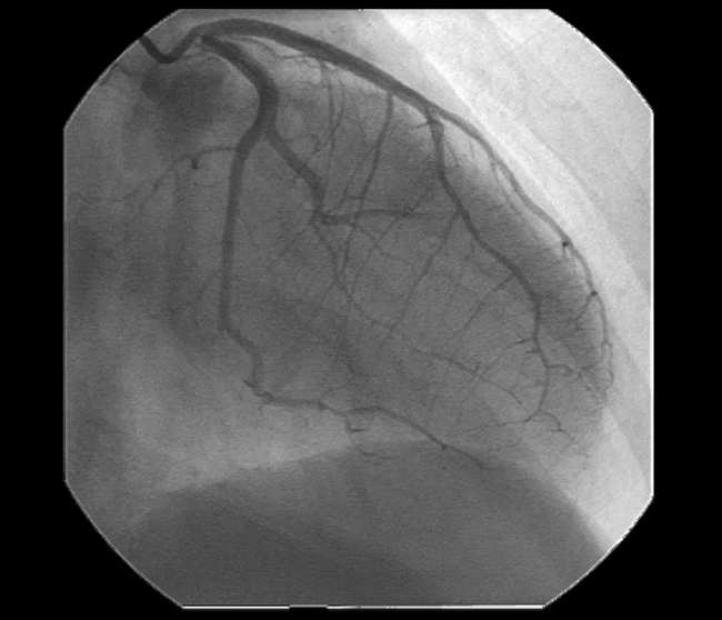 写真：心臓のX線撮影（提供：国際医療看護福祉大学校）