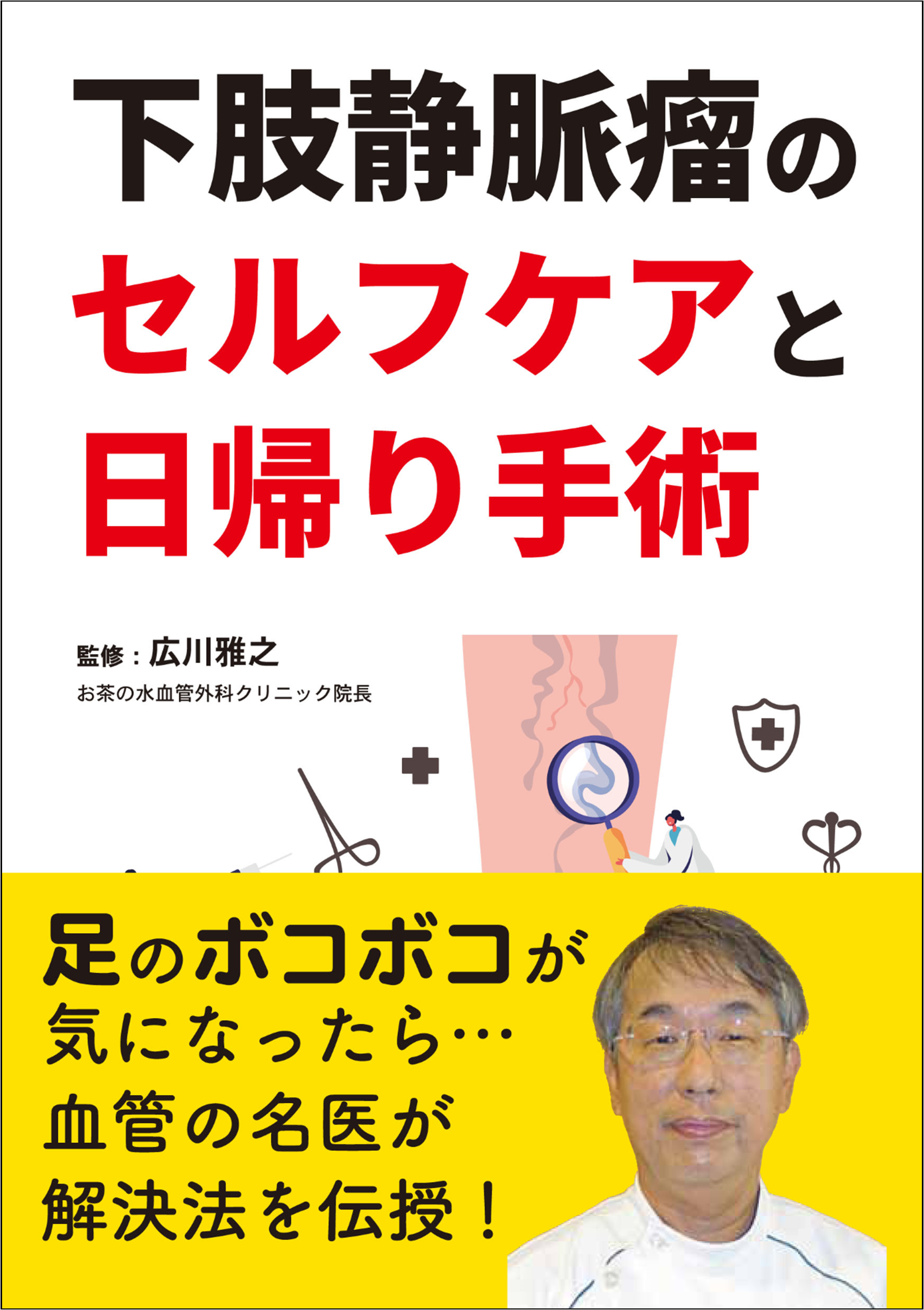 足の血管がふくれてコブのようになっている とお悩みの方へ 気になる症状をセルフケアor日帰り手術で治す 株式会社自由国民社のプレスリリース