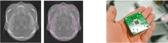 頭部ファントムのX線カラーイメージング像（左）とTlBrイメージセンサ（右）