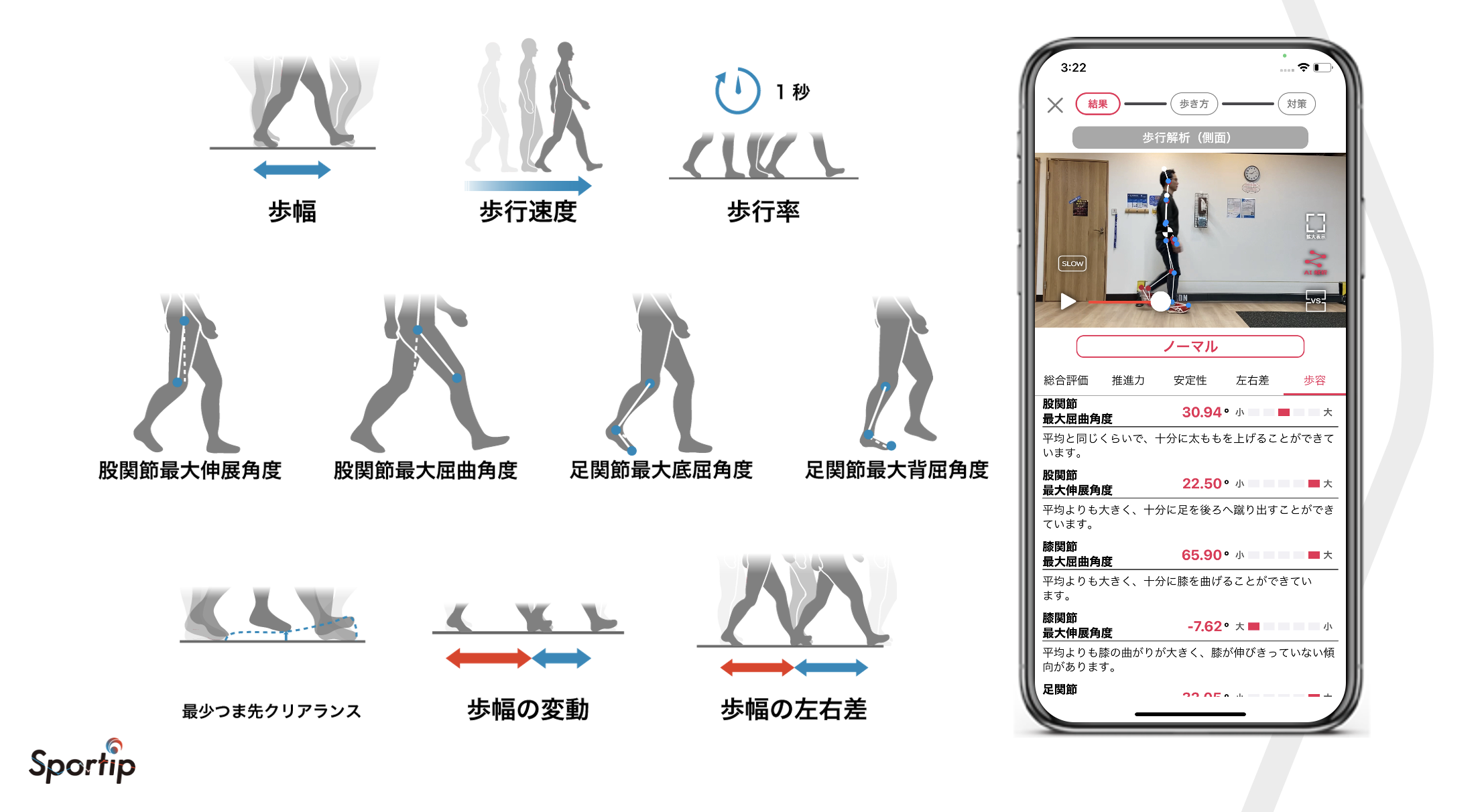 整体 接骨院 デイサービス向けai姿勢 歩行分析アプリ Sportip Pro に歩行解析 側面 機能追加 株式会社sportipのプレスリリース