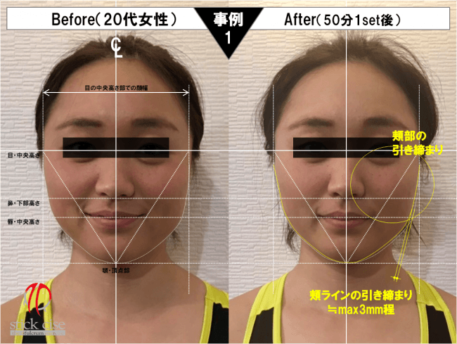 スティック活用の全身運動と音波式振動によって小顔効果を生む 小顔スティックサイズ スタート 株式会社セルビスタのプレスリリース