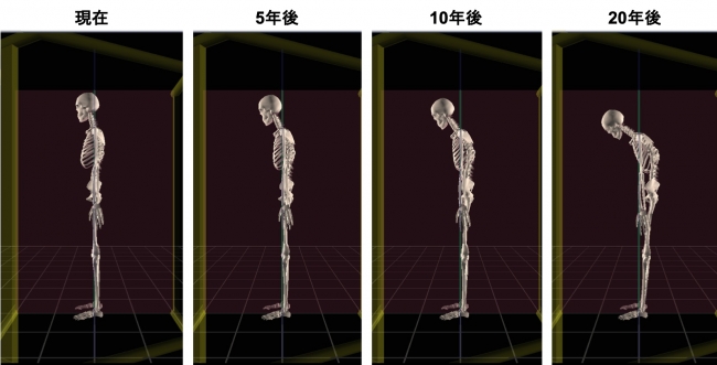 酒井慎太郎氏作成のデスクワークによって加速される うつむき姿勢から20年後を予想した図