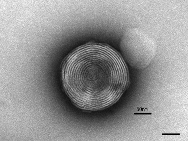 多重層バイオリポソームの電子顕微鏡画像