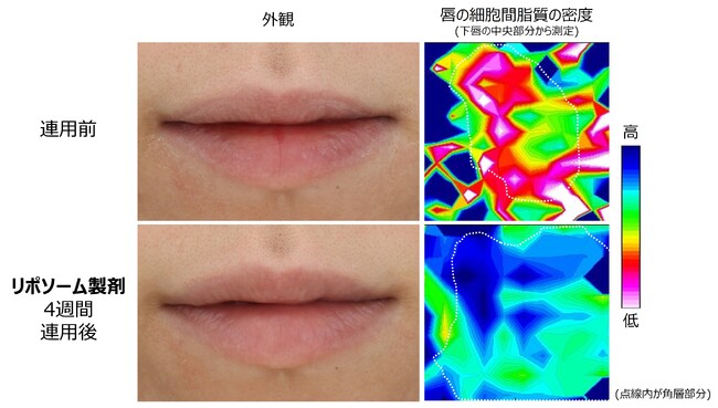 図3　リポソーム製剤の唇あれに対する効果検証の一例 (外観および赤外分光法による解析)