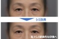 シミ部位と対人印象の関係を解明 目まわりのシミ改善により若々しく健康的な印象へ