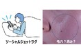 社会的時差ぼけ「ソーシャルジェットラグ」が毛穴の目立ちや顔の赤みを引き起こすことを確認