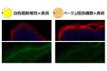エネルギーを燃やす「ベージュ脂肪細胞」が肌のバリア機能を高めることを発見