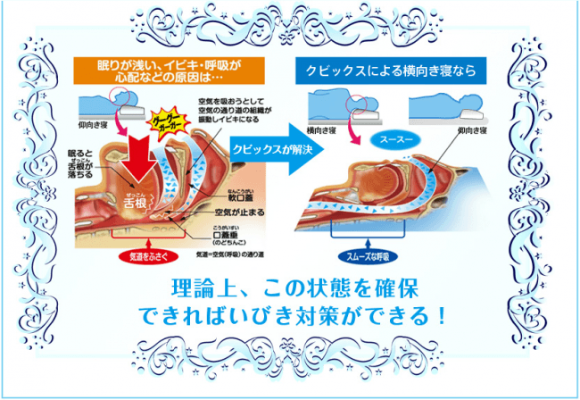 方法 いびき 治す