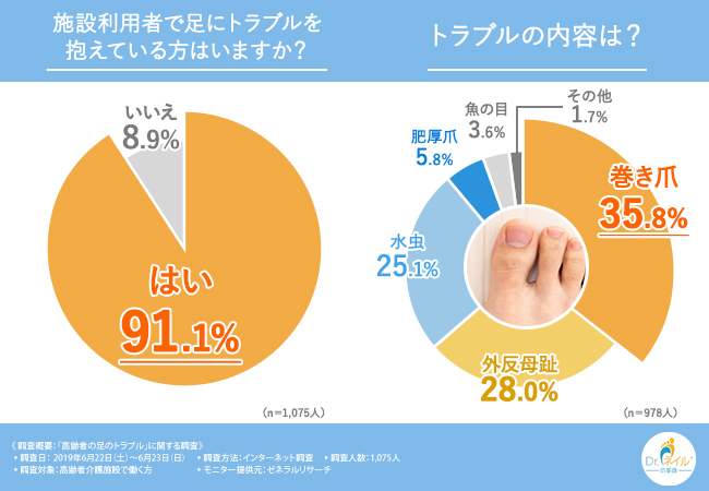 足爪トラブルは寝たきり生活の一歩手前 足 爪トラブルを対処できる施設は３割にも満たないとが判明 利用者がケガ等のリスクを負うことなく処置できる方法とは 在宅医療マッサージ株式会社のプレスリリース