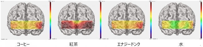 図２：記憶課題遂行時の脳血液量の変化の画像の比較