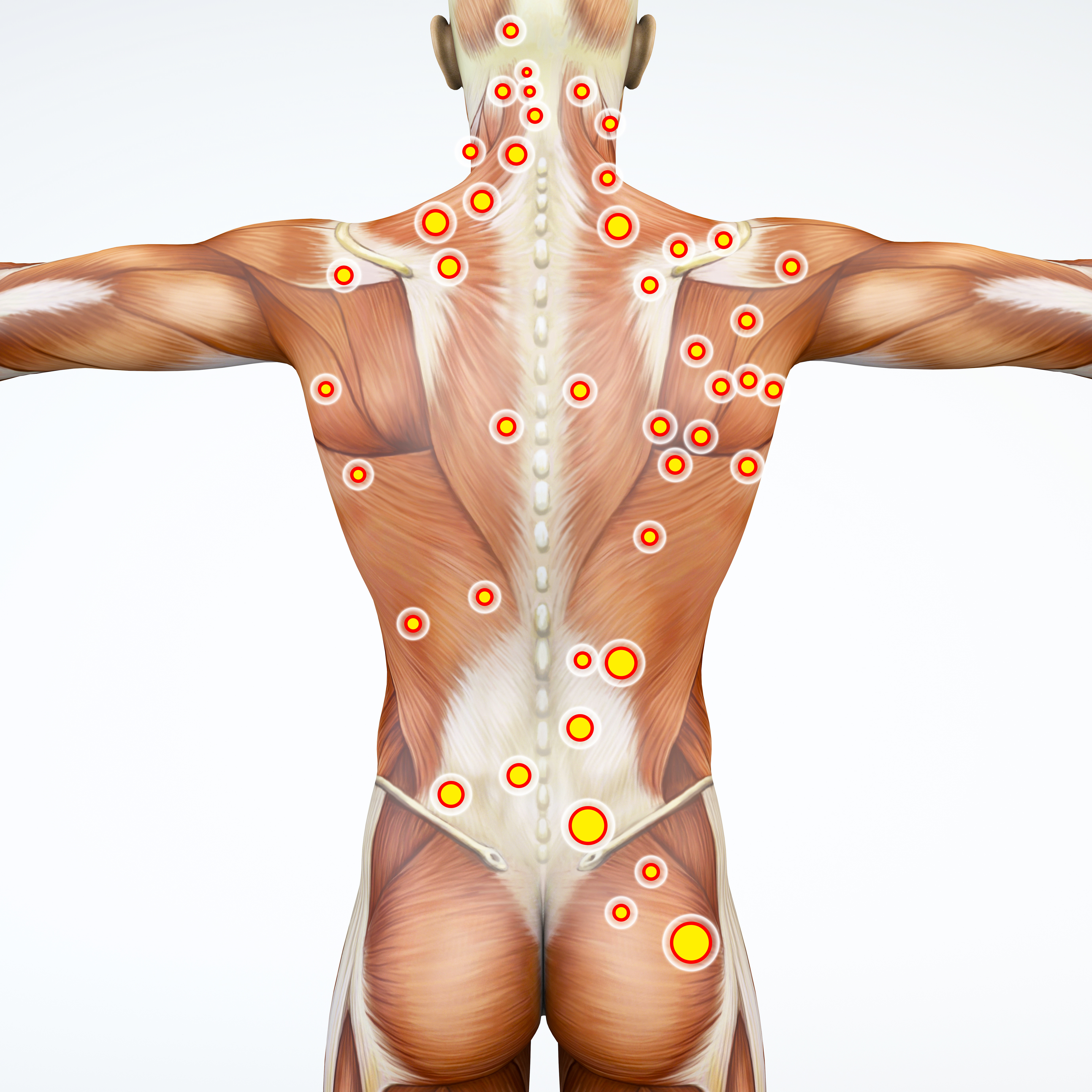 慢性痛の原因 トリガーポイント 身体の相関パターンから痛みの根源を分析することで的確に改善 解剖学生まれの 筋 筋膜 トリガーポイント講座を年3月から開催 株式会社zen Placeのプレスリリース