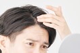 ■男性８割が抱える「頭髪・頭皮の悩み」／６割以上が頭髪ケアを実施、その理由トップ３【①身だしなみ ②薄毛予防 ③頭皮の健康維持】 　～ 20～60代男性941名へ「夏の頭髪・頭皮ケア」を調査 ～