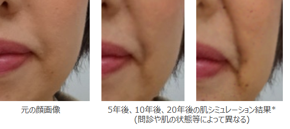 元の顔画像(図左)で検知したほうれい線、フェイスラインのたるみの色や下方への歪み等が、さらに進行している状態(図中央、右)