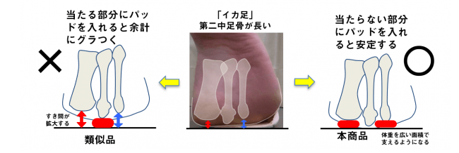 「イカ足サポーター」の原理