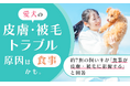 愛犬の皮膚・被毛トラブル、原因は"食事"かも。約7割の飼い主が「食事が皮膚・被毛に影響する」と回答