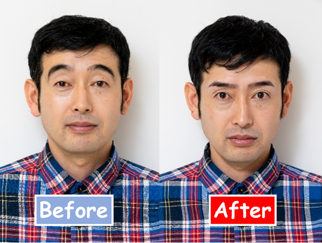 Before After画像