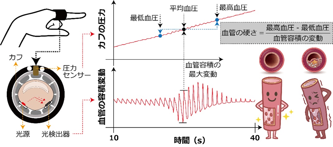 血管の硬さ、血圧、心拍数、一つの“指輪”で明らかに｜福岡工業大学のプレスリリース