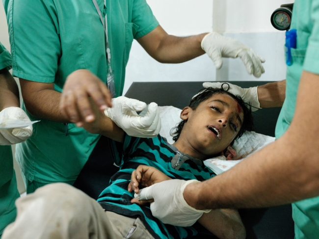 南部タイズにあるMSFの病院で治療を受ける7歳の少年。爆発物の破片によって負傷した（2018年3月撮影）(C) Matteo Bastianelli