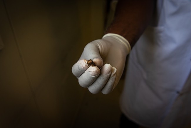 ポルトープランスで、銃撃された患者から摘出した弾丸を見せるMSFの医師。この地域では流れ弾が問題になっている＝2022年6月20日　(C) Johnson Sabin
