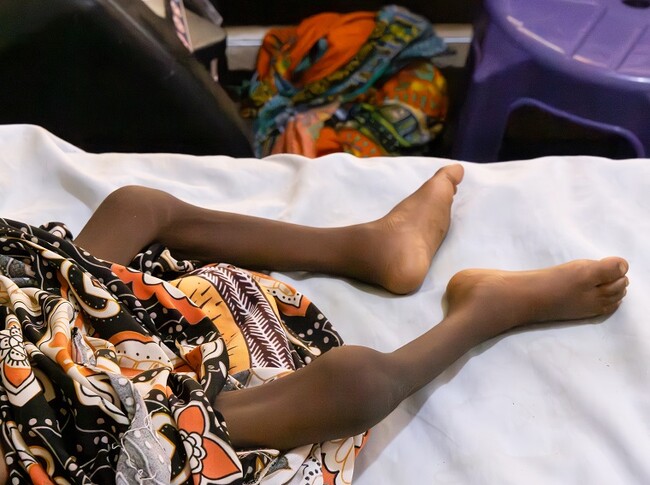 MSFの栄養治療センターに入院する幼児。運ばれてきた時は発熱、嘔吐、下痢を繰り返していた＝2023年5月12日 (C) Ehab Zawati／MSF
