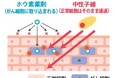 株式会社CICS(リゾートトラスト株式会社の連結子会社)、血管肉腫を対象としたBNCT(ホウ素中性子捕捉療法)の国内第Ⅱ相臨床試験の主要評価に関する90日間の観察期間が完了