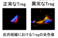免疫系細胞の異常が皮膚の老化を促進する新たなメカニズムを解明～制御性T細胞（Treg）の異常が老化細胞の蓄積を促進させる～