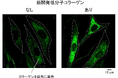 肌・骨・関節のコラーゲン産生を高める低分子コラーゲンを開発！ ～グリシルプロリン高含有で、コラーゲン合成の司令塔に働きかける～
