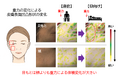 目もとは頬より重力による影響を受けやすい！～重力による皮膚の“歪み”が目もと特有のエイジングに関与～