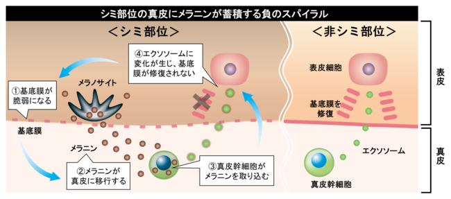 シミ部位の真皮にメラニンが蓄積するメカニズム