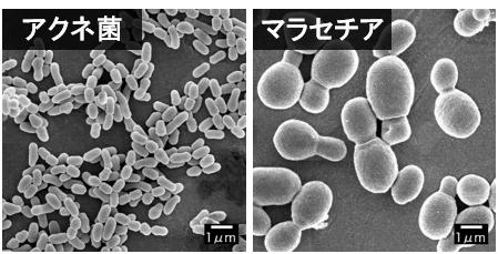 アクネ菌とマラセチアの顕微鏡写真