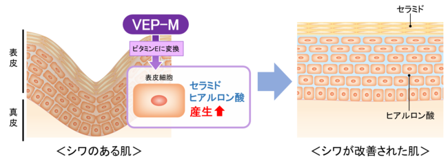 図4　VEP-Mによるシワ改善メカニズム