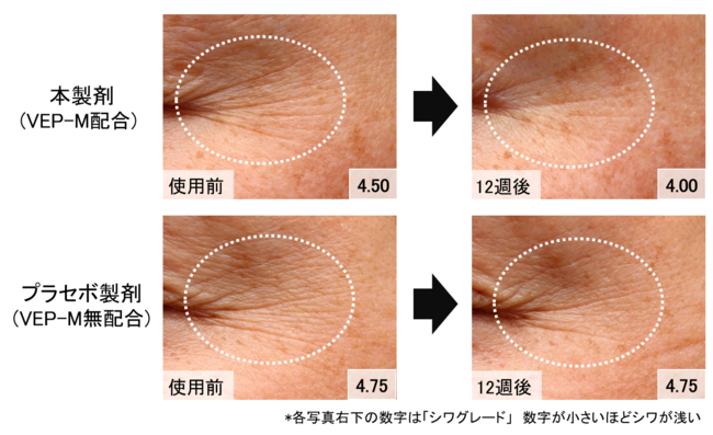 図1　本製剤によるシワ改善効果代表例（48歳女性）